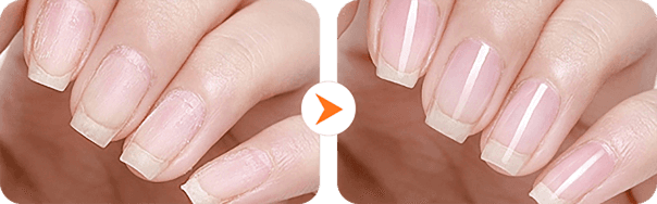 Coupe-ongles électrique automatique