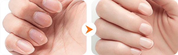 Coupe-ongles électrique automatique