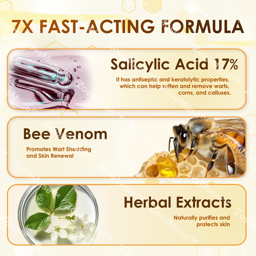 🐝 Crème anti-cors et callosités au venin d’abeille