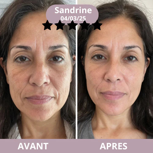 Soin anti-rides à effet immédiat