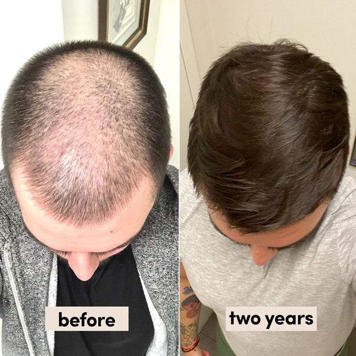 Le spray ULTRA HAIR GROWTH