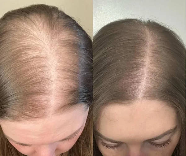 💆‍♀️ Sérum Roll-On pour la croissance des cheveux