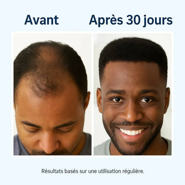 💆‍♀️ Sérum Roll-On pour la croissance des cheveux