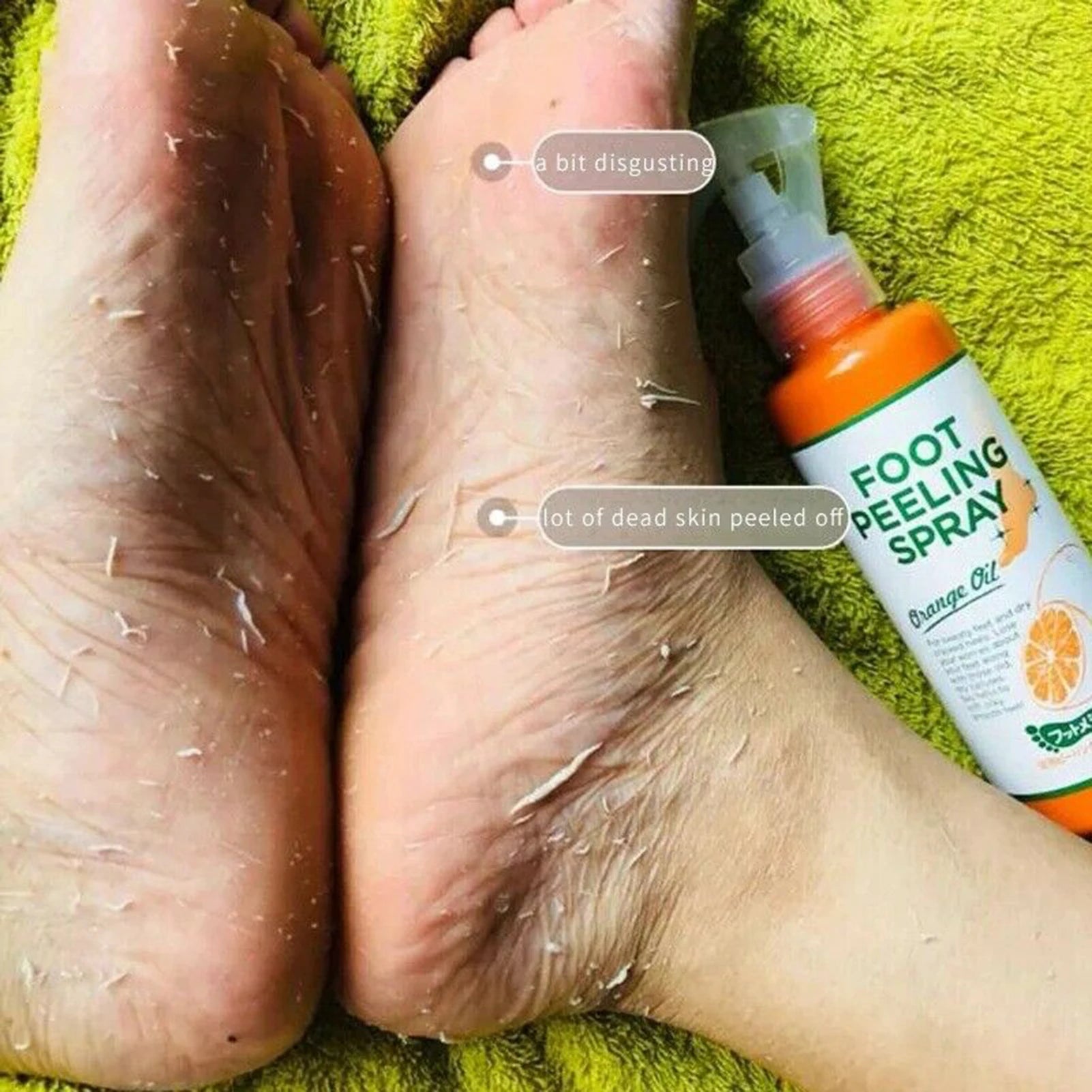Stop aux Pieds Secs – Spray Exfoliant Pieds Anti-Callosités