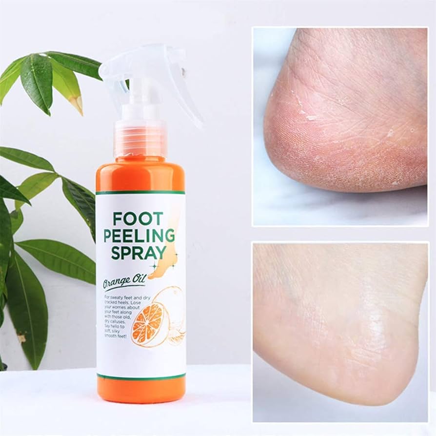 Stop aux Pieds Secs – Spray Exfoliant Pieds Anti-Callosités
