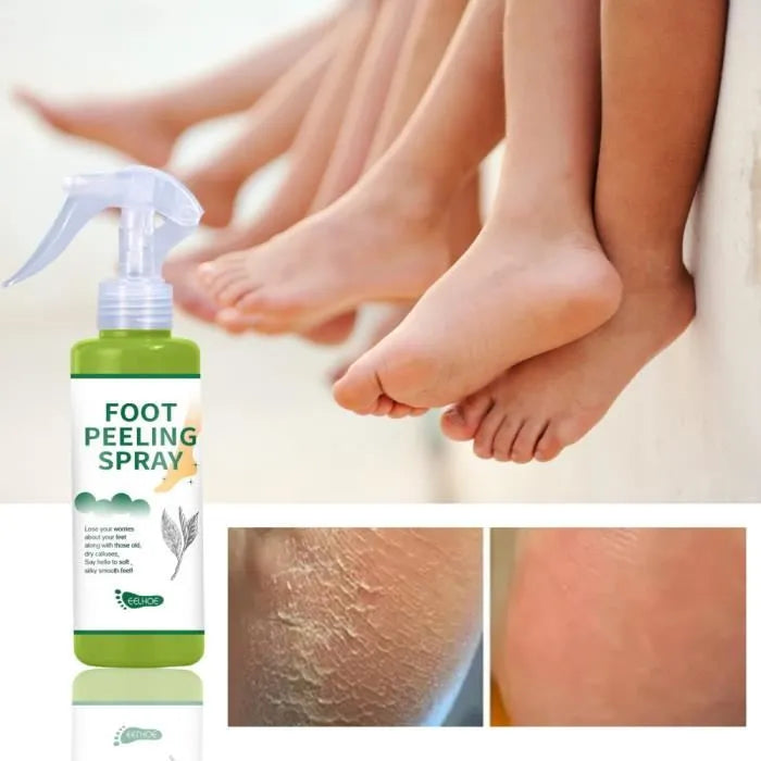 Stop aux Pieds Secs – Spray Exfoliant Pieds Anti-Callosités