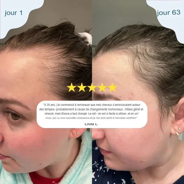 💆‍♀️ Sérum Roll-On pour la croissance des cheveux