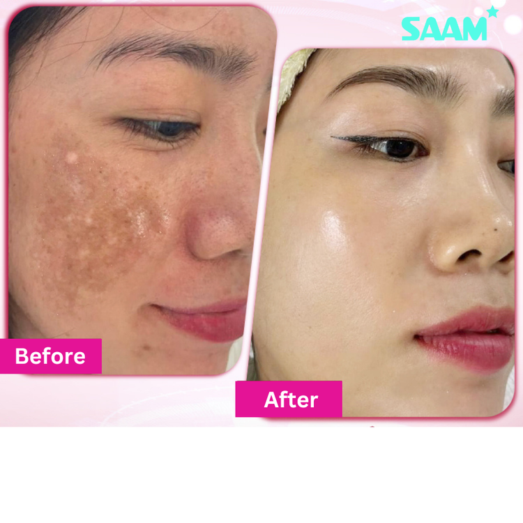 SAAM Renewal face cream