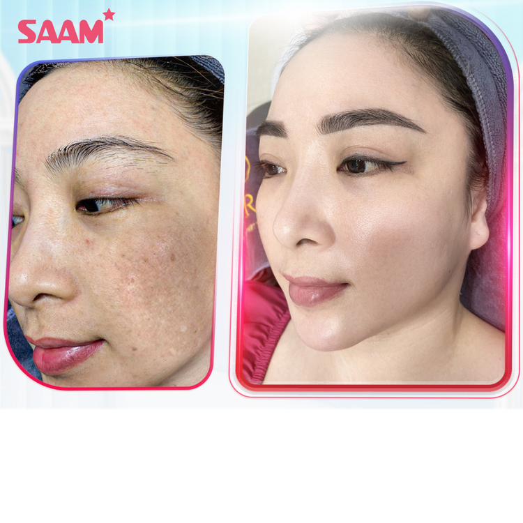 SAAM Renewal face cream