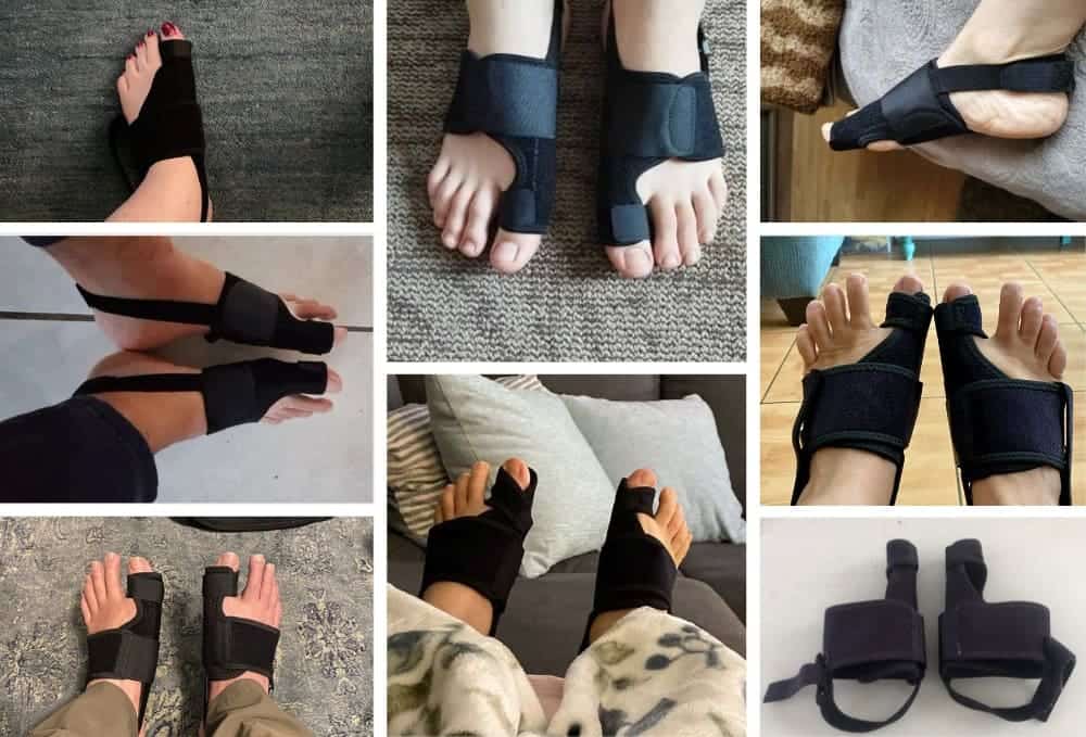 Ortisoin™ Correcteur d’Hallux Valgus | Corrige l’alignement de l’orteil en seulement 14 jours