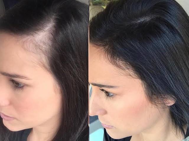 Le spray ULTRA HAIR GROWTH