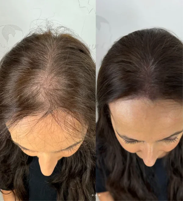 💆‍♀️ Sérum Roll-On pour la croissance des cheveux
