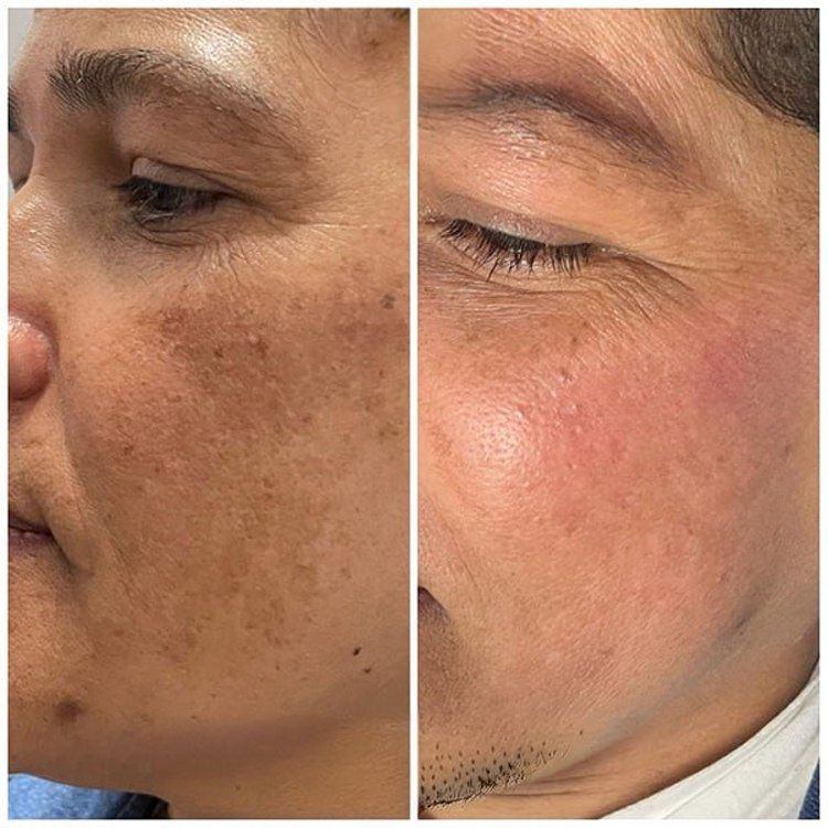 SAAM Renewal face cream