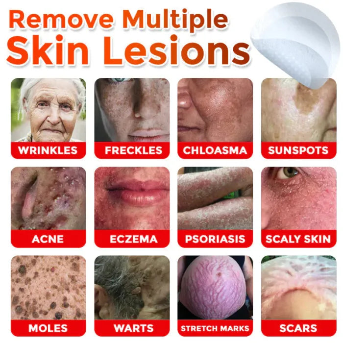 Skin tag removal patches
