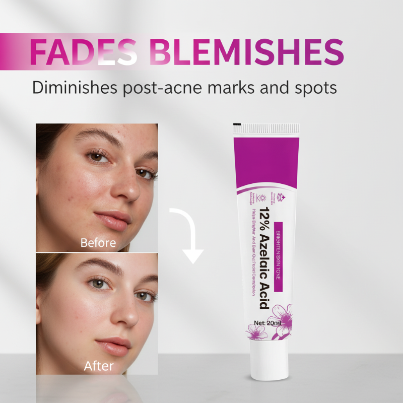 Crème anti-acné à 12 % d'acide azélaïque (20 ml)