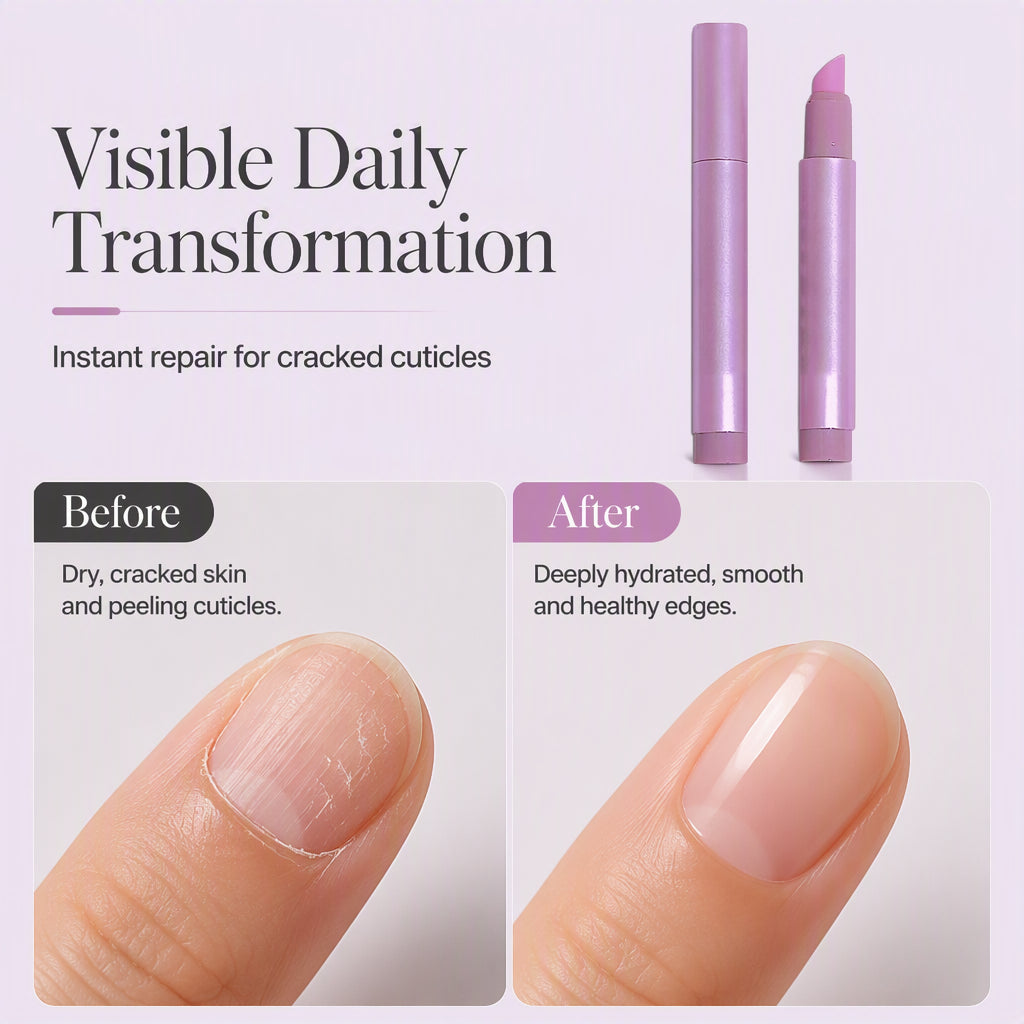 Stylo à Huile pour Ongles – Embout Applicateur de Précision, Formule Hydratante & Design Portable for des Cuticules Nourries et Élégantes ✨
